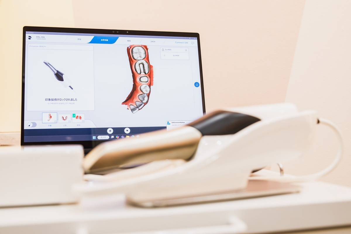 3Dスキャナーによる診断