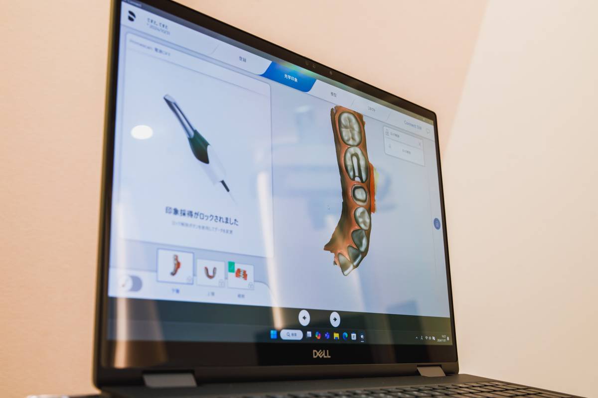 治療計画のご説明